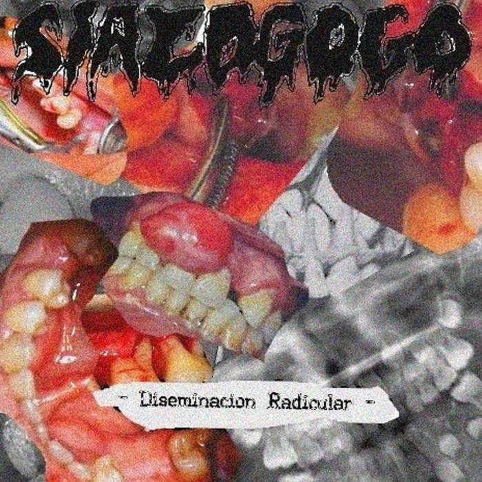 Diseminación Radicular