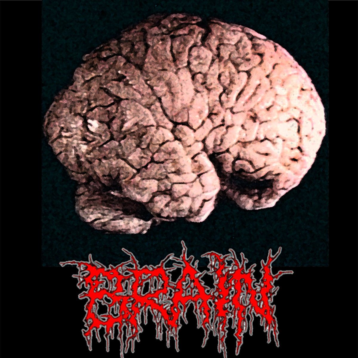 Brain