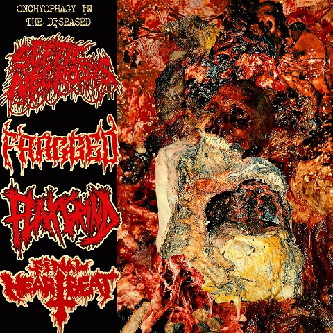 Onychophagy in the Diseased