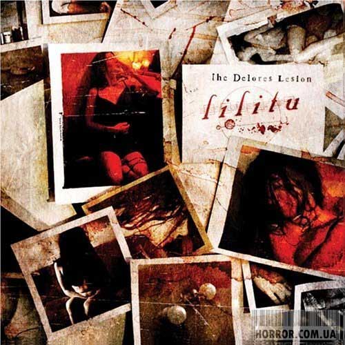 The Delores Lesion
