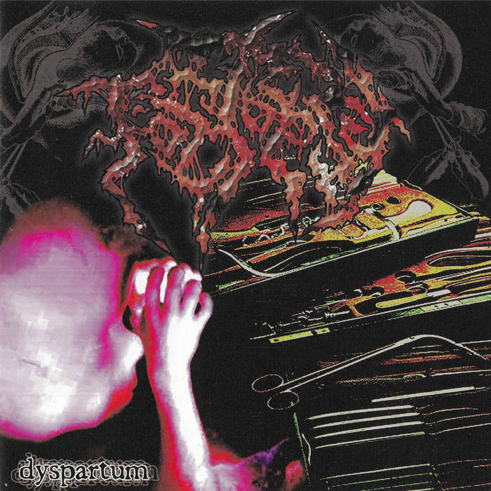 Dyspartum