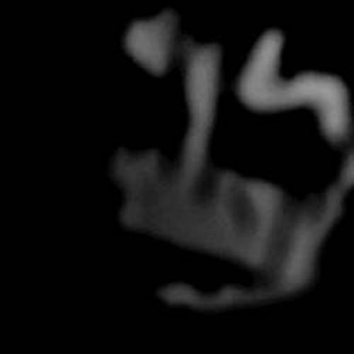 666