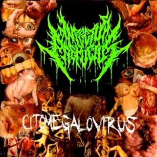 Citomegalovirus