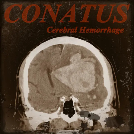 Cerebral Hemorrhage