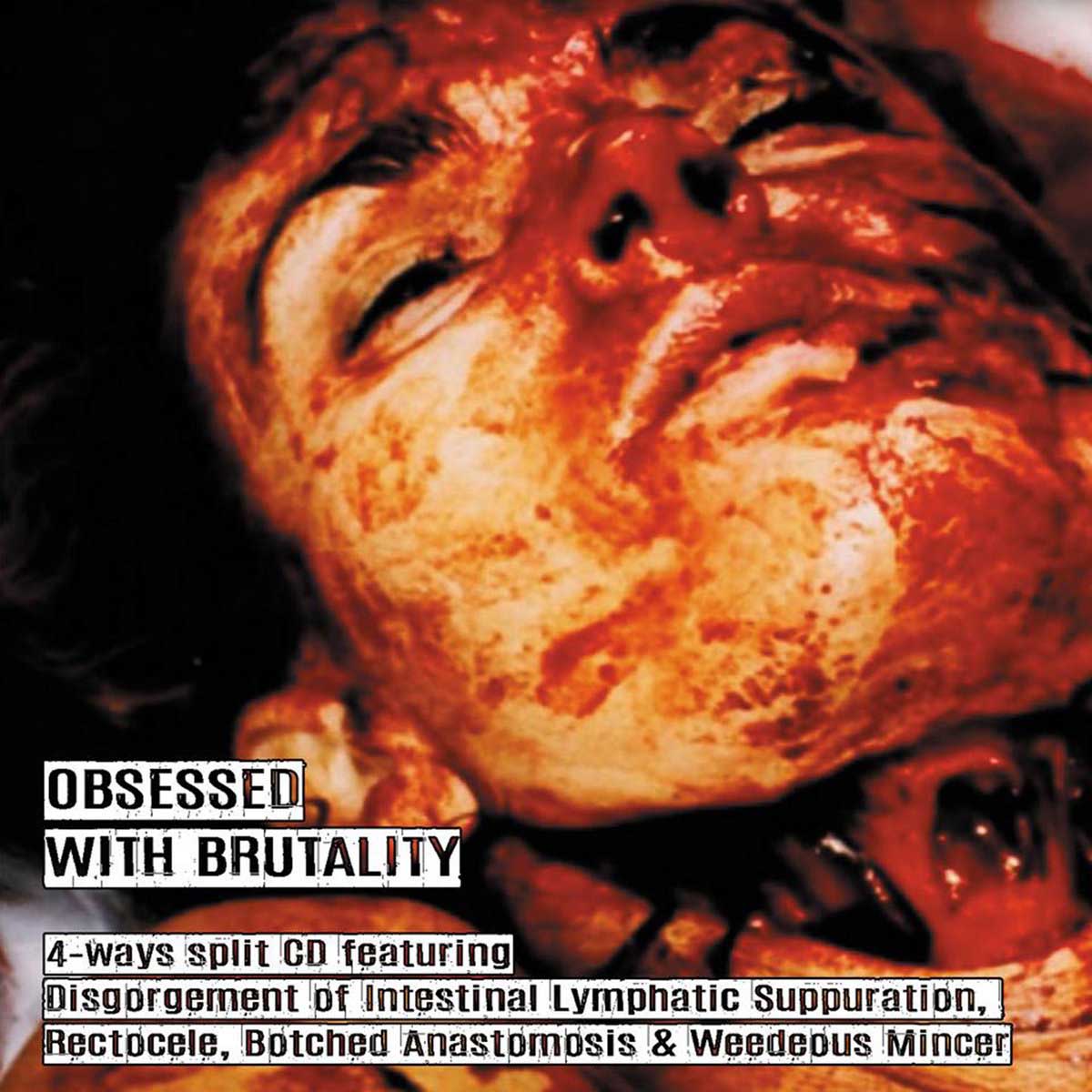 Split con Disgorgement of Intestinal Lymphatic Suppuration, Botched Anastomosis J​-​Pouch & Weedeous Mincer