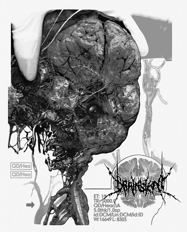 Brainstem