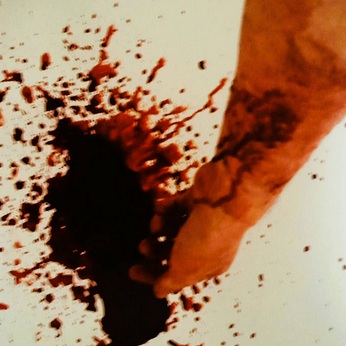 Monarchy of Terror on the Broken Mind by Voorh's Disease