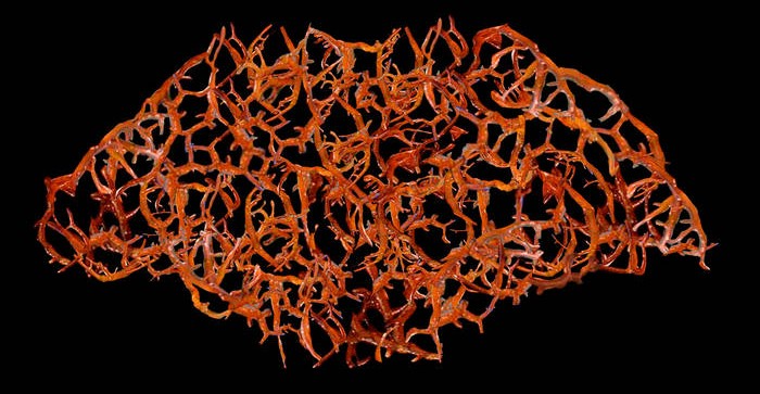 Rupture of the Gastrointestinal Tract
